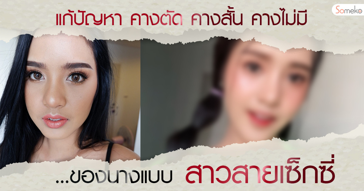 คางตัด คางสั้น คางไม่มี!